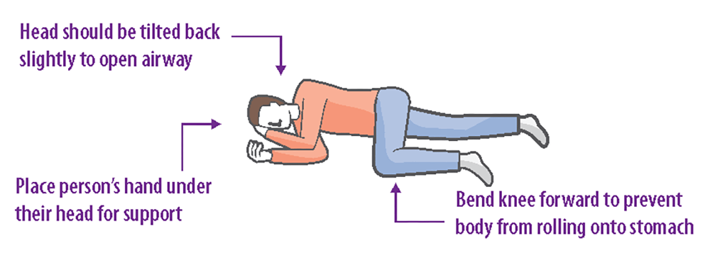 Recovery position from 5 steps to save a life