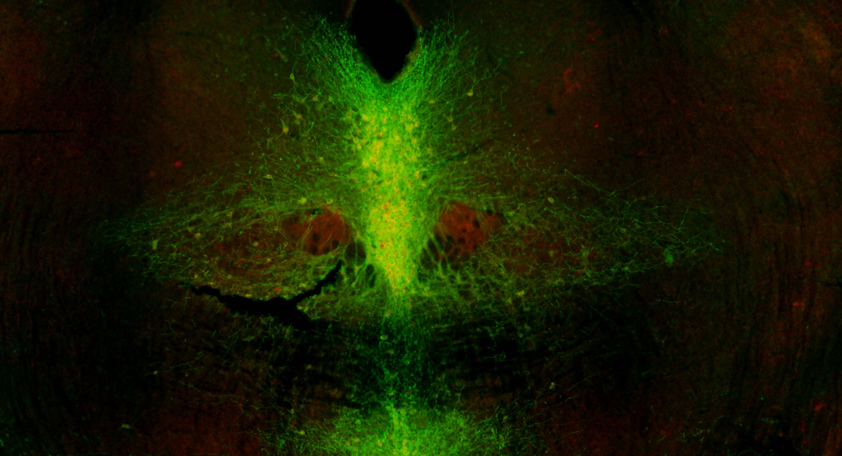 Optogenetics